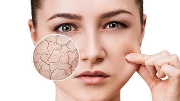 پوست دهیدراته - اسکین مال